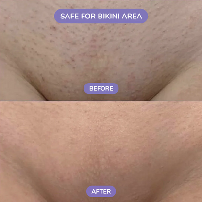 SilkStone™ Crystal Hair Eraser Stone